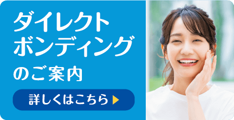 ダイレクトボンディングのご案内