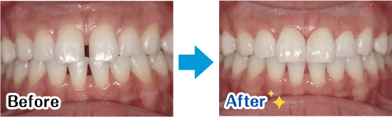 Before→After