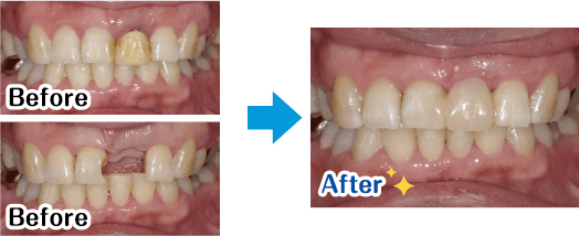 Before→After