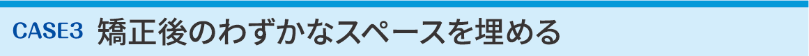 CASE3 矯正後のわずかなスペースを埋める