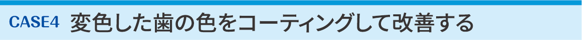 CASE4 変色した歯の色をコーティングして改善する
